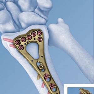 _trauma_1651166679.jpg